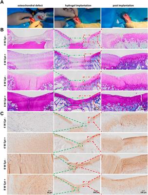 Etanercept embedded silk fibroin/pullulan hydrogel enhance cartilage repair in bone marrow stimulation